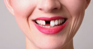 Dramatic! O treime dintre părinți nu și-au dus niciodată copiii la dentist