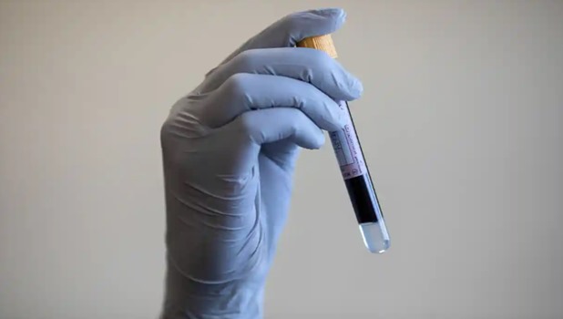 eprubeta test