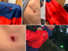 FOTO. Bărbat atacat de câini în Parcul Noua din Brașov! Victima dă declarații la Poliție