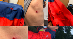 FOTO. Bărbat atacat de câini în Parcul Noua din Brașov! Victima dă declarații la Poliție