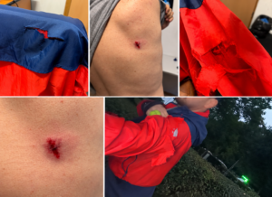FOTO. Bărbat atacat de câini în Parcul Noua din Brașov! Victima dă declarații la Poliție 1 DFC994FC A086 4258 BDB8 7D984A0992D5